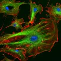 Cytoskjelett Mikrofilamenter Oppbygging: Trådformete fibre. Funksjon: Form: Opprettholder eller forandrer cellens form. Bevegelse: Beveger cellen, f.eks. kontraksjon i muskelceller.