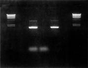 Appendix B: Agarose Gel Analysis of Plasmid DNA The QIAprep Miniprep procedure can be analyzed using agarose gel electrophoresis as shown in Figure 5.