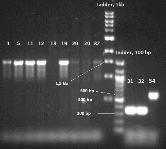 Figur 20. Gel elektroforese av PCR-produkt. Isolat nr. 1, 5, 11, 18, 19, 20, og 32 etter PCR med prokaryot primer, og isolat nr. 31, 32 og 34 etter PCR med eukaryot primer.