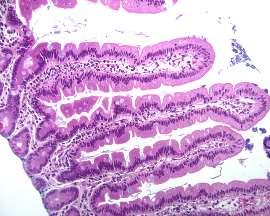 serology Marsh 0 & neg