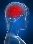 Migrene Migrenen kommer i hovedsak som anfall og kan vare fra 3-72 timer. Det er to hovedtyper; med og uten aura (forvarsel som regel i form av synsforstyrrelse).