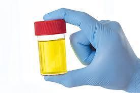 Urinens sammensetning Urin består av vann, avfallsstoffer og overflødige salter. Stoffer som blir reabsorbert fra urin tilbake til blod er f.eks.