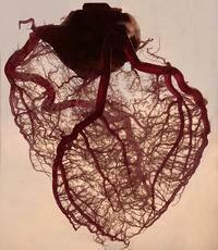 Akutt behandling Pasienter med hjerteinfarkt. Iskemisk hjertesykdom Kalles også koronar hjertesykdom, dvs.