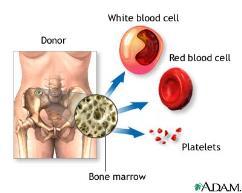Stoffer nødvendige for å produsere røde blodceller Jern Vitamin B12 Folsyre Hvis noen av disse stoffene mangler, vil ikke ben-