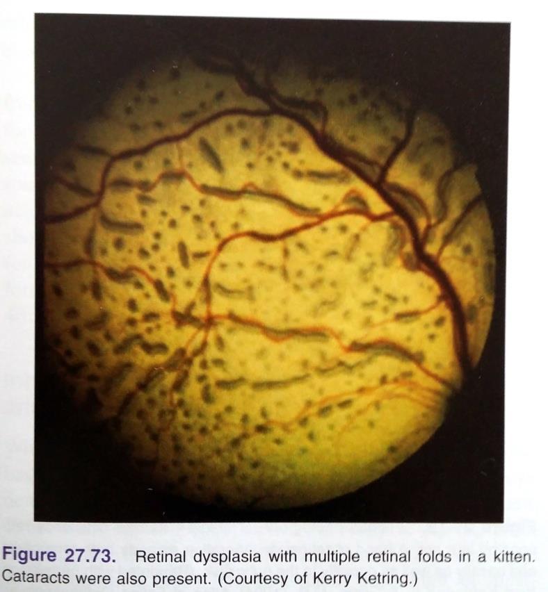 Misdannelse Retinal