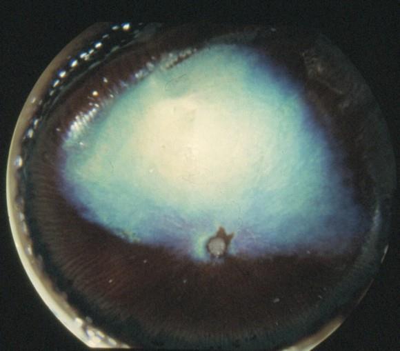Normal retina Velutviklet tapetum hos de fleste