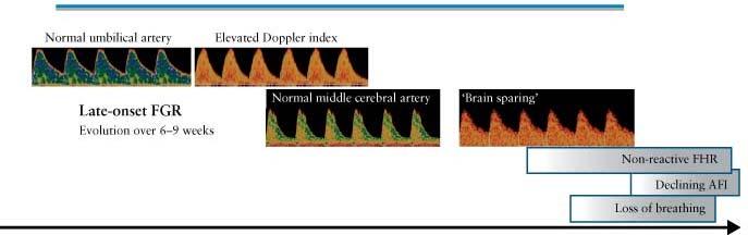 solid lines represent the 95% confidence interval for each Doppler index. For stillbirths: Crimmins. Doppler and biophysical profile in FGR stillbirths.