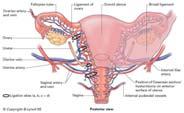 iliaca interna Supravaginal uterusamputasjon/hysterektomi Pakking av buken Observasjon under