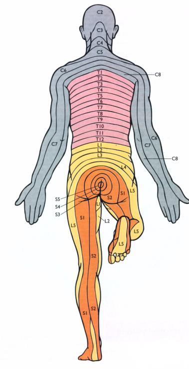 19 Dermatomer Et dermatom er et hud område som får sin sensoriske nerveforsyning fra ett ryggmargssegment Skade på en spinalnerve gir derfor