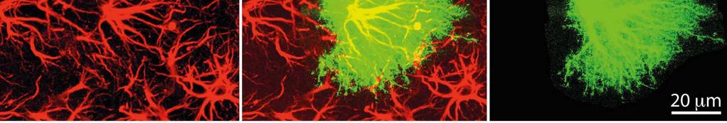 Astroglia Endeføtter Arterie Astroglia CSF Pia Astroglia Ependym Neuron Membrana