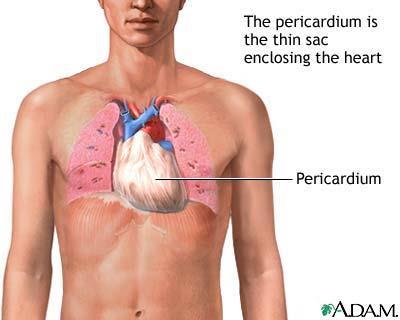 Perikard (hjerteposen) Bindevevssekk rundt hjertet. To lag Parietalt lag: Ytterste laget.