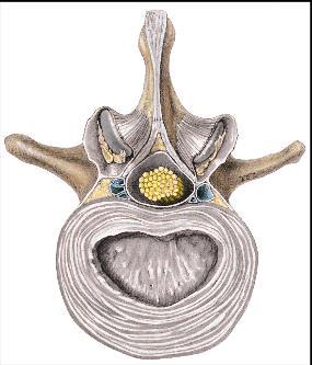 Foramen vertebrale 35 Discus intervertebrale (Anatomiboken Leddlære s 49) Lumbalvirvel med