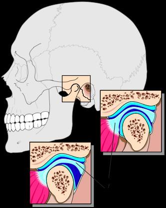 Art. Temporomandibularis (Anatomiboken