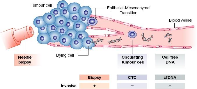 behandling Tilbakefall av kreftsykdom http://www.cancergenetics.