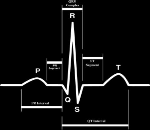 EKG Komplekset ST-intervall forandringer (eventer)