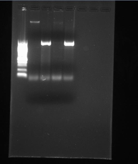 16 Invert gelbilde av ESBL- og Car- singleplex PCR på positive vannprøver.