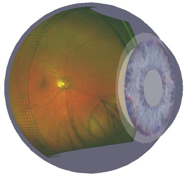 skader synsnerven slik at synet gradvis går