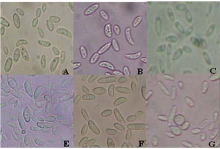 Morphological and molecular characterization o Fusarium spp. 33 FIGURE 3. Macroconidia of Fusarium species.