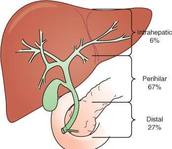 Cholangiocarcinomer 120/år i Norge, 25 % aktuelle for kirurgi