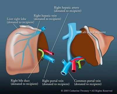 Leverkirurgi: begrensninger Ethvert menneske er avhengig av en funksjonell restlever Arteriell inflow Portal