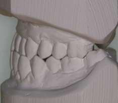 Clinical Findings Occlusal