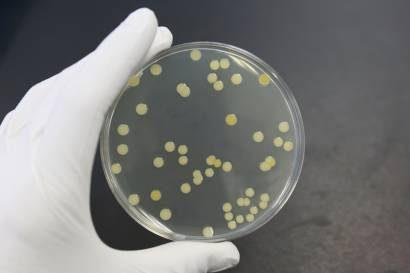 Endring i hudens mikrobiom Friske har stor diversitet S.