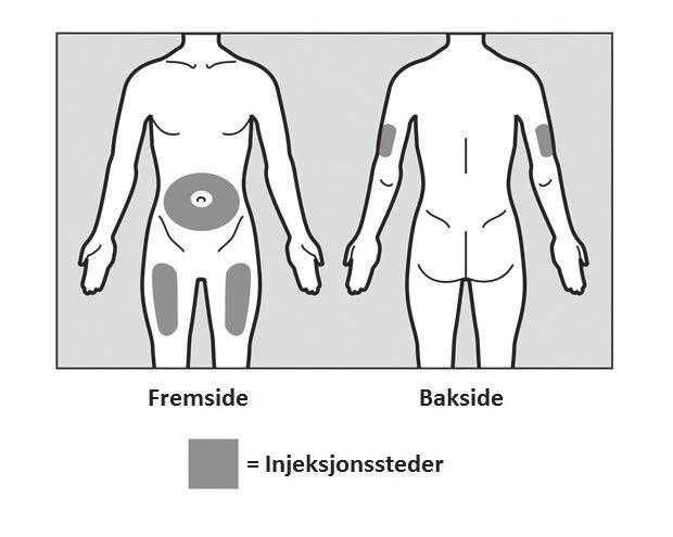 Kontroller at esken ikke er skadet. Ikke bruk enheten hvis det ser ut som at esken er skadet. Kontroller utløpsdatoen på enheten.