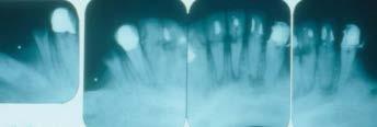 Tannleger og pasienter har forskjellige oppfatninger om: evaluering av