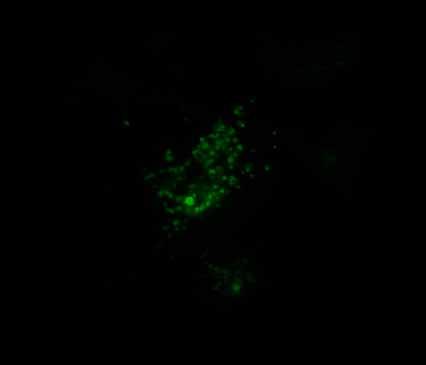 Lysotrackergreen (LTG) staining Nile red staining LTG: