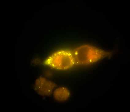 accumulate in acidic organelles as the result of protonation Nile