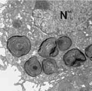 human fetal lung treated with DCI medium