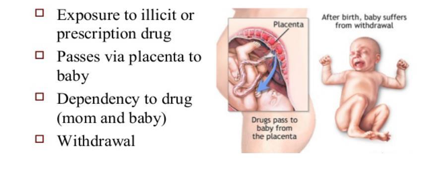 Neonatalt abstinens syndrom (NAS) et begrep som dekker de symptomer som nyfødte