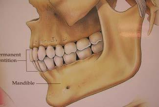 Kjevebein-endringer etter tann-tap Gradvis tap av alveolarbein kan resultere i en knife edge kjevekam