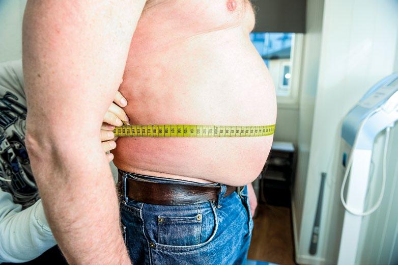 Forskning: Har du stor mage, er risikoen for å få hjernesag eer hjerteinfarkt mye større enn for de som bare er overvektige, uten å ha mye av fettet passert rundt ivet.