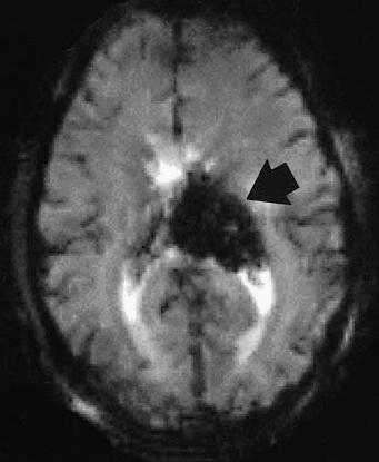 DCE-MRI paradigm