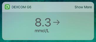 Vedlegg B: Utvid appen Med G6-appen ser du varsler fra låseskjermen eller smartklokken. Ser du ingen data? Åpne appen. B.1 I dag-visning (Apple) Sjekk CGM-bekreftelsen i I dag-visning, selv når smartenheten er låst.