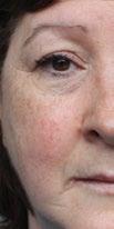 Inneholder ageloc, en patentert teknologi som bekjemper hudens synlige aldringstegn ved kilden. Trett og stresset hud forvandles til hud som umiddelbart føles oppfrisket, silkemyk og ren.