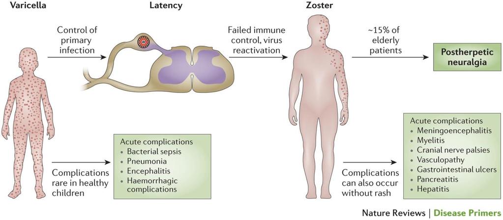 Varicella-zoster-virus (VZV) Som alle herpesvirus vil viruset etter
