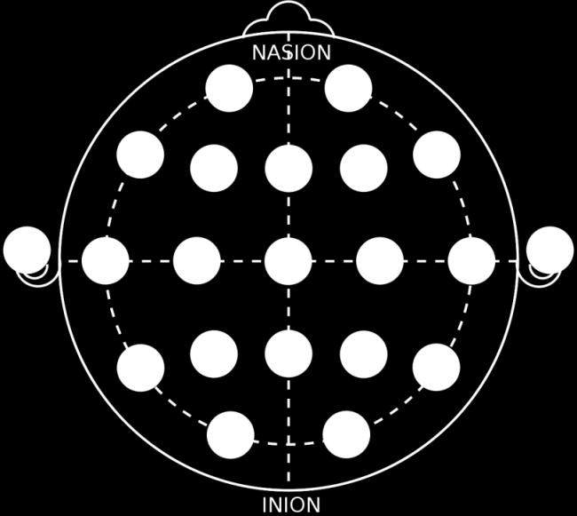 EEG: Standard EEG/søvndeprivert EEG,1 døgns EEG registrering,