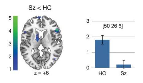 fmri Tijdens herinterpreteren: minder activatie frontaal