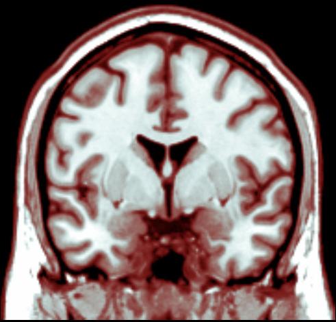 Helemaal niet negatief Heel erg negatief Komt overeen met eerdere studies (Van Rijn et