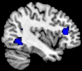 taak Risicogroepen - fmri 7 0 Herinterpreteren vs Kijken naar neg