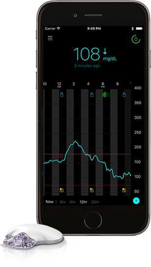 connect CGM