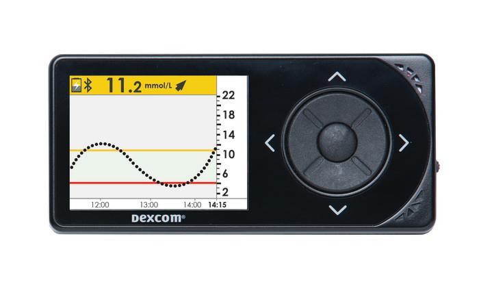 CGM= kontinuerlig glukose monitor CGM= kontinuerlig vevsglukose måler En CGM utfører 288