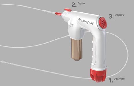 Hva med de pasienter hvor en ikke oppnår hemostase ved medikamentell og