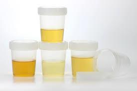 Indikasjon for dyrkning av urin Ukomplisert UVI kan behandles empirisk på bakgrunn av symptomer og det er ikke nødvendig med prøvetaking til dyrkning og resistensbestemmelse - behandlingen tar