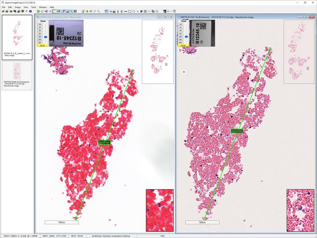 Same slide scanned on multiple scanners Viewed in same viewer using «20x» magnification Observations: - Different distance measurements - Different