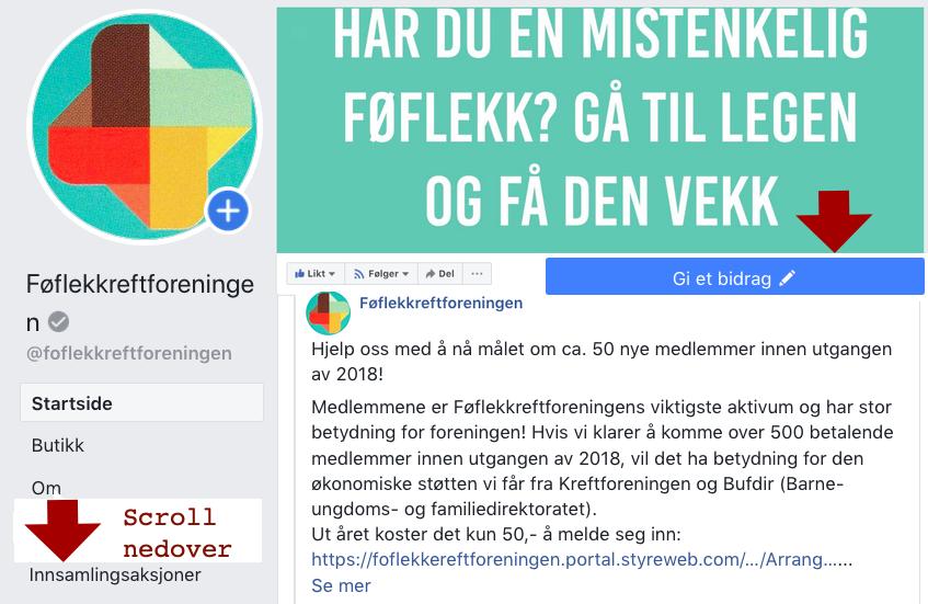 Føflekkreftforeningens personvernerklæring Styret i Føflekkreftforeningen har nå utarbeidet en personvernerklæring som synliggjør at vi ivaretar medlemmenes personvern.