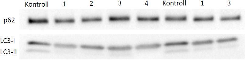 Figur 3.1: Representative proteinbånd i cytosolfraksjon. Tallene indikerer biopsirekkefølge der 1 og 2 er fra akuttdag 1 mens 3 og 4 er fra akuttdagen etter intervensjonen. Figur 3.