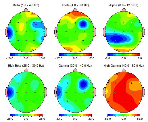 signifikante endringer i produksjon av theta (4-8 hz) og high gamma (40-50 hz).